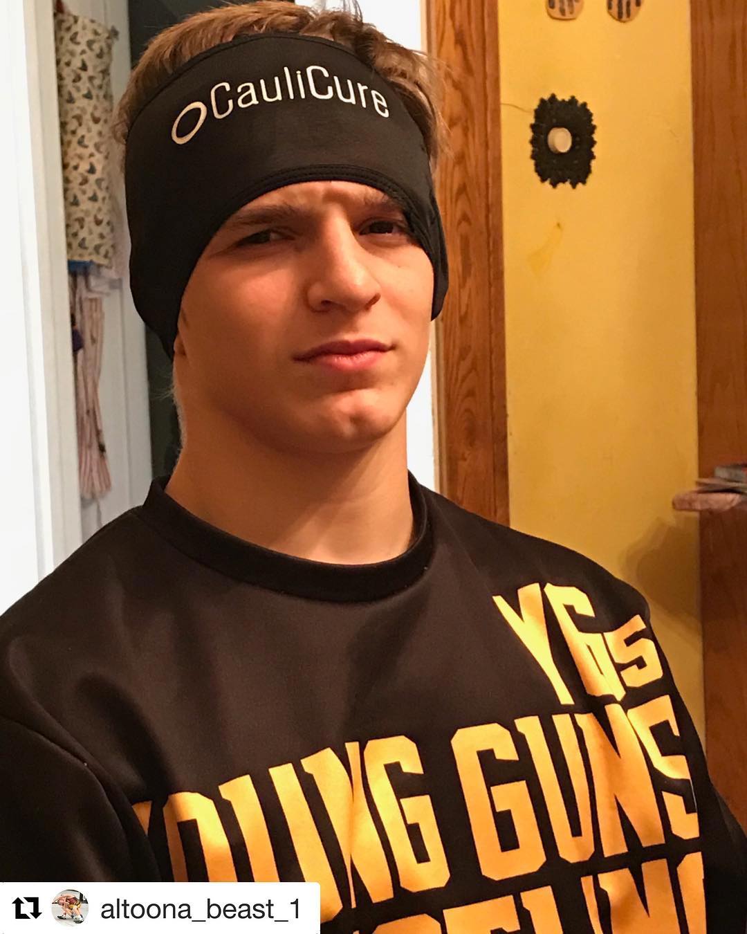 Cauliflower Ear Under Control